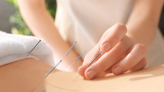 Dr. Jayne Dabu's Tips for Acupuncture Over 40